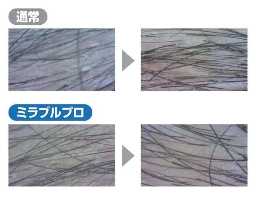 業務用】ミラブルプロアルファ ＜ストレート水流＆ミスト水流＞ 在庫