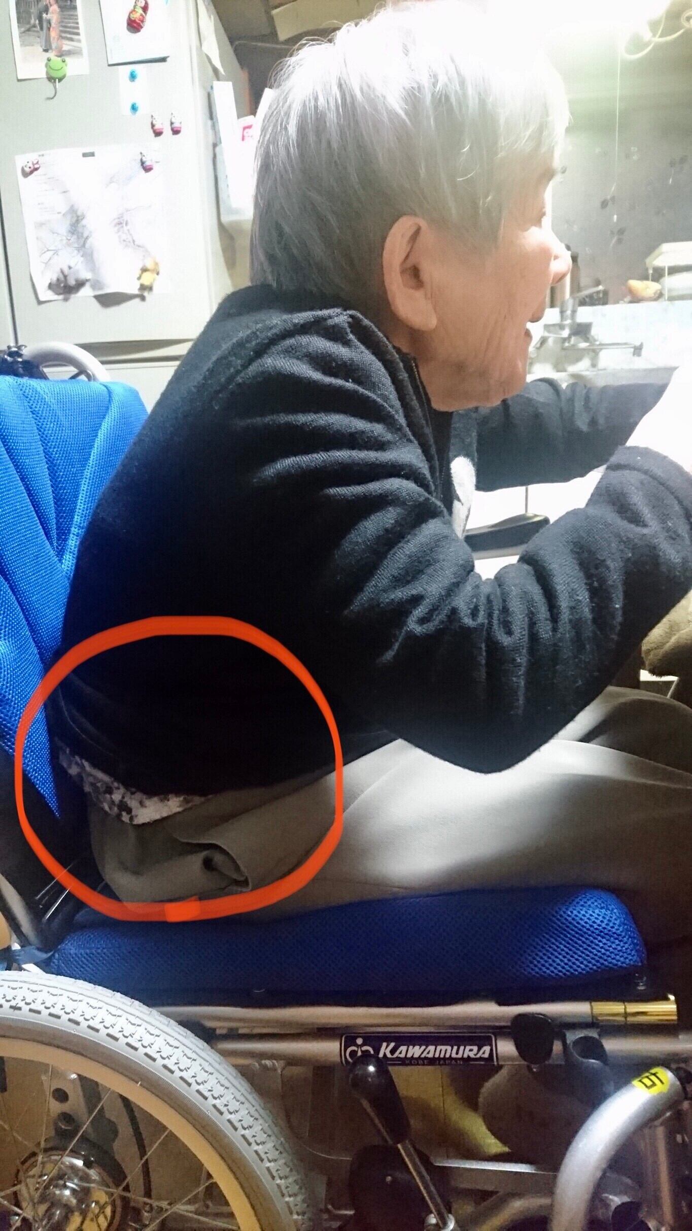 背中が出ています