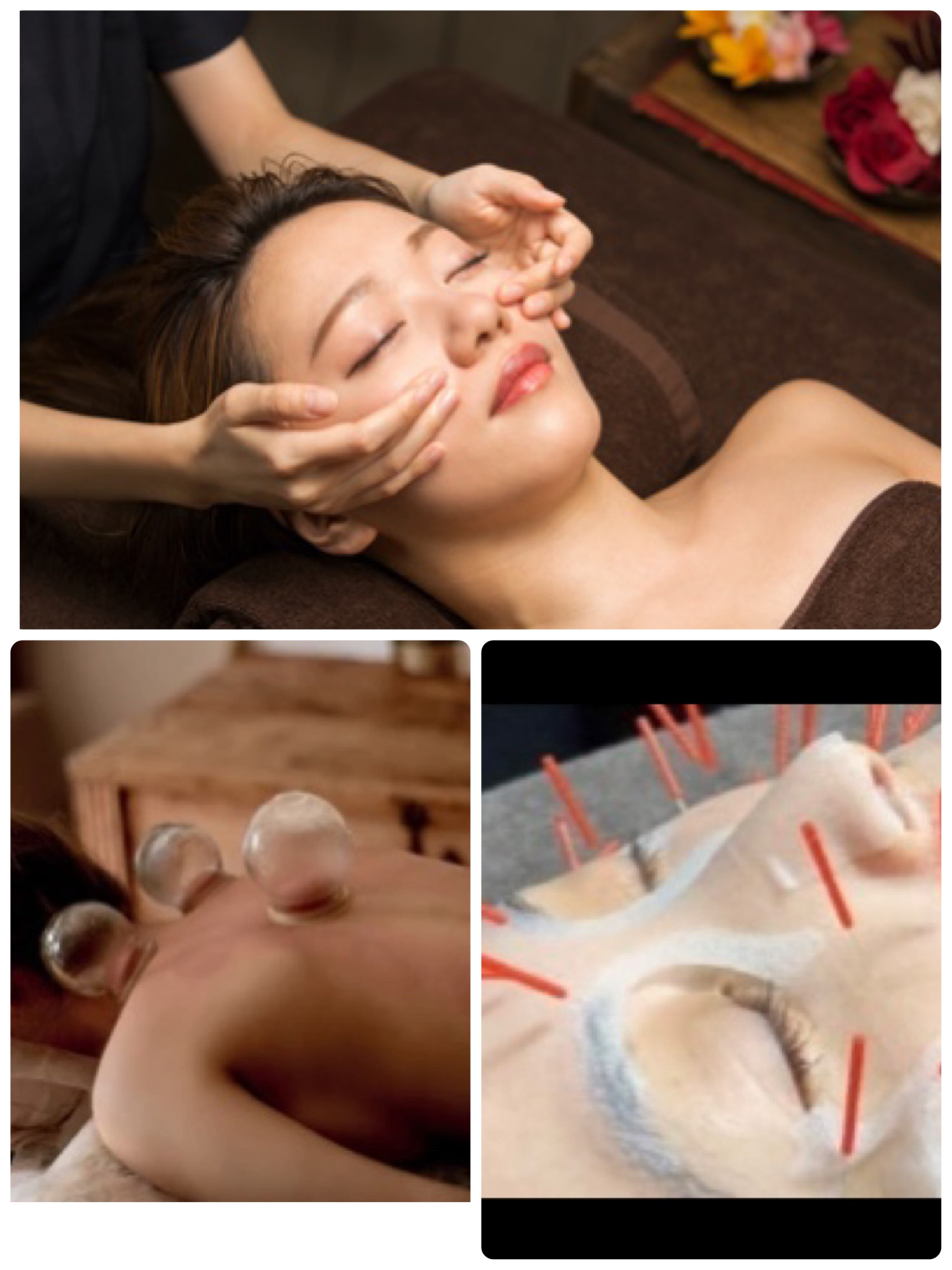 #筋膜小顔整体　#毒素排出　#吸玉　#幹細胞美容鍼