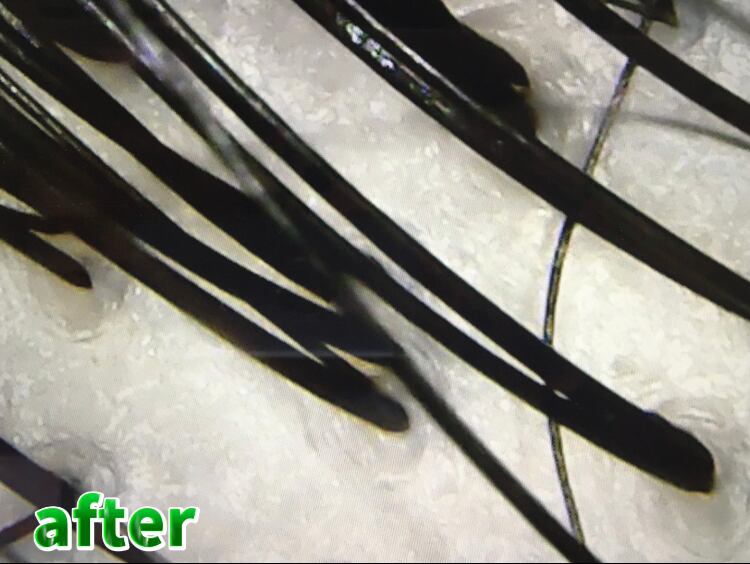 ドリーミングオイルのクレンジングを続けることで健康な頭皮へ導こう！