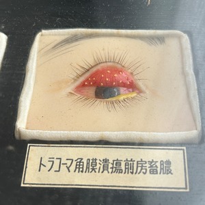 1950年代　眼科用結膜炎模型　