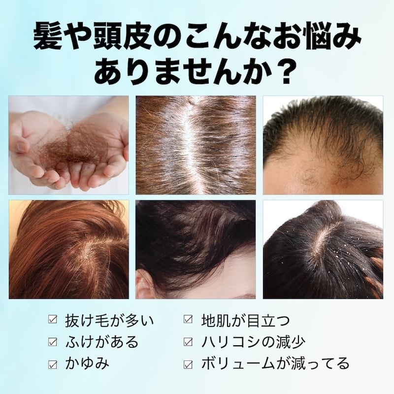 発毛促進 育毛 薄毛 抜け毛 育毛剤 医薬部外品 ボタニカル 無香料