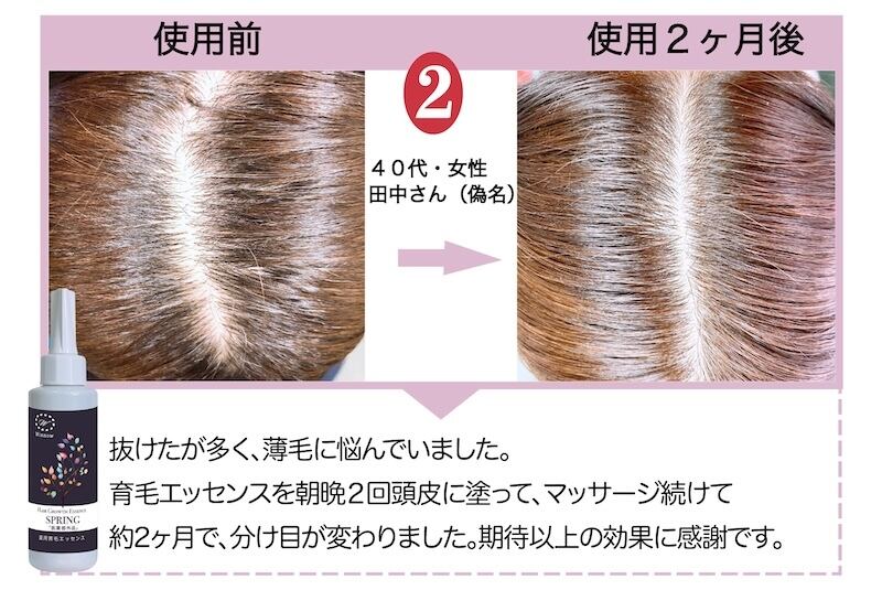 発毛促進 育毛 薄毛 抜け毛 育毛剤 医薬部外品 ボタニカル 無香料