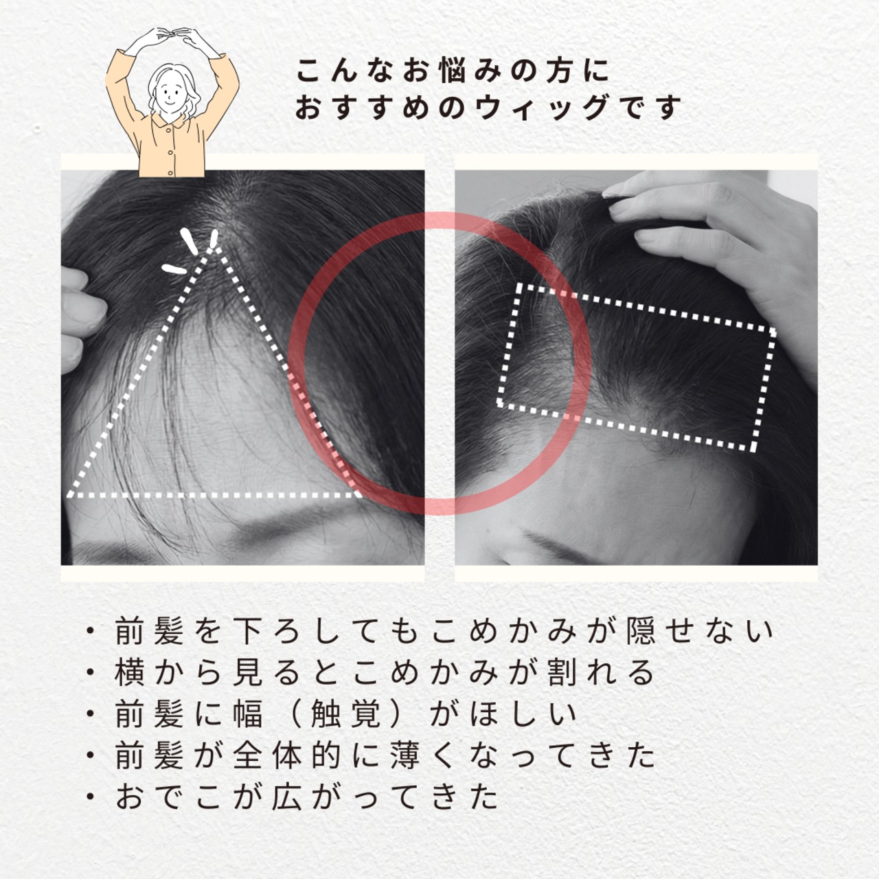 【医療用ウィッグ】 人毛100% ちょこカバウィッグ T型 |フル卒 部分ウィッグ 前髪・こめかみの薄毛カバー 部分ウィッグ【前髪側8cm分け目4cm×10cm】