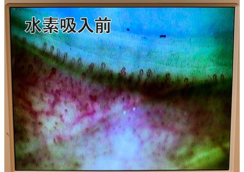 ドクター水素ボトル | TOKIKO CLINIC online store