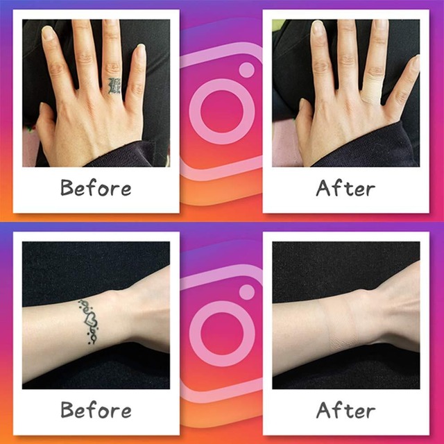 ファンデーションテープ (タトゥー隠しシール 刺青を隠す) 色合わせセット 各1色ずつ 5シート入 防水 日本製 特許取得済み 絆創膏サイズ (2.6x7cm)