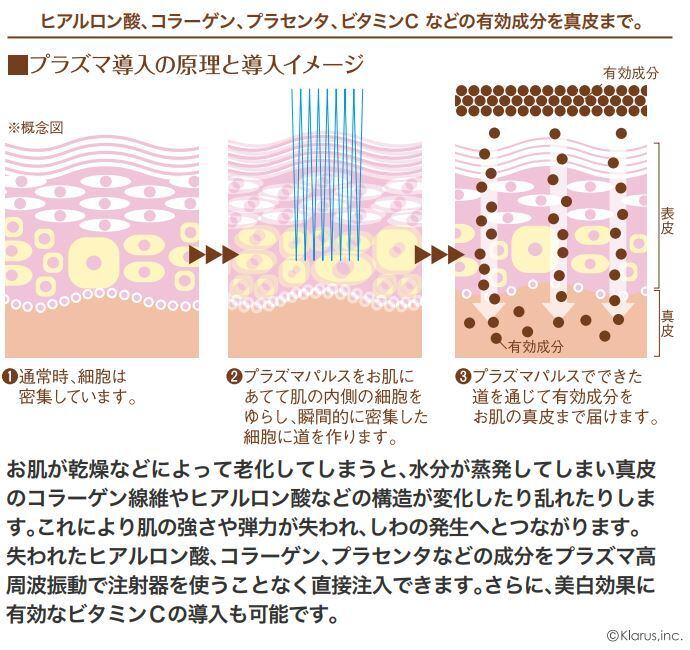 プラズマボーテ 美顔器   ハンディタイプ美顔機 ホワイト