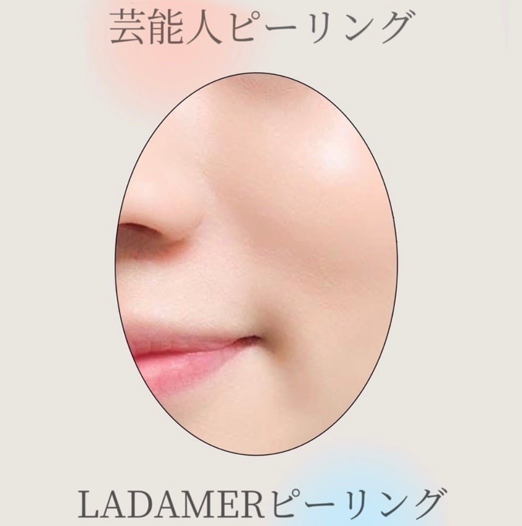 LADAMER ラダメール ピーリング ピンプルパッド 30枚入 | REVIA