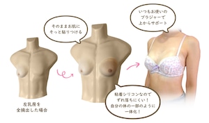 【セミオーダー人工乳房・Lサイズ】D～Fカップ相当