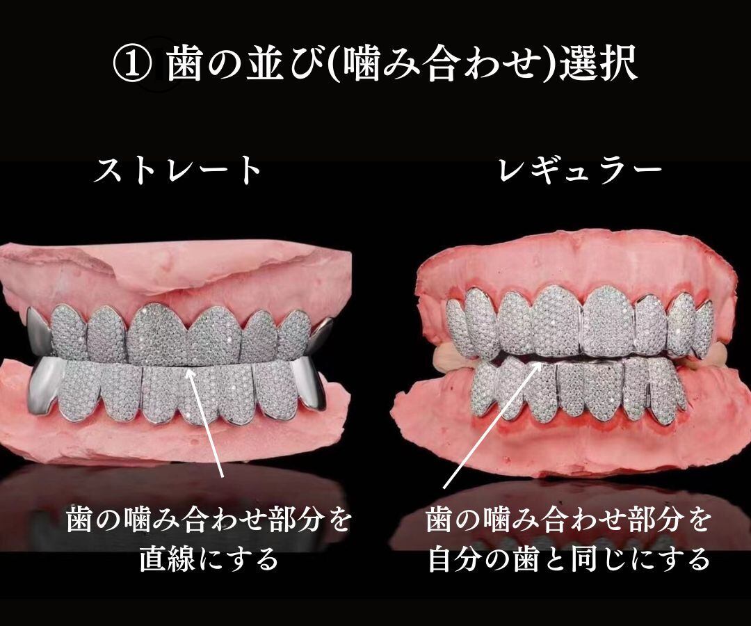 s925 Iced Out Grillz | Glitter