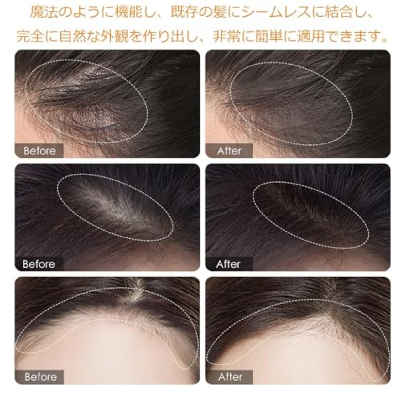 UNYOKE ヘアボール ヘアシャドウ ダークブラウン/ウォータープルーフ/小顔メイク/生え際・薄毛/生え際パウダー 1個(×1)-5#ブラック