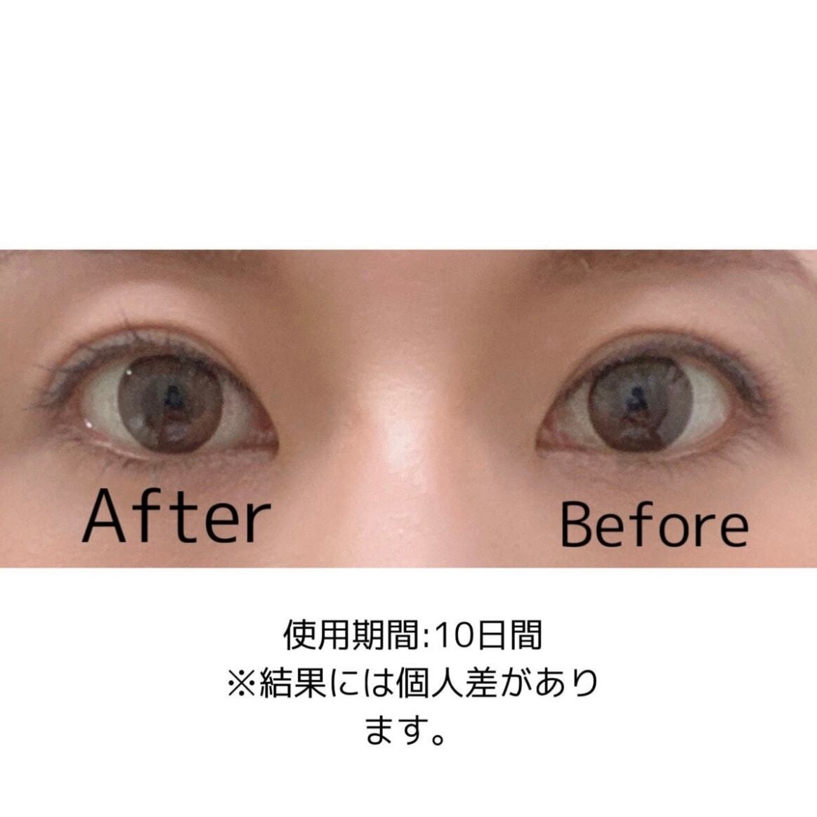 テラケア アイ 3ml / CARENESS（ケアネス） | 【正規販売店】サロン