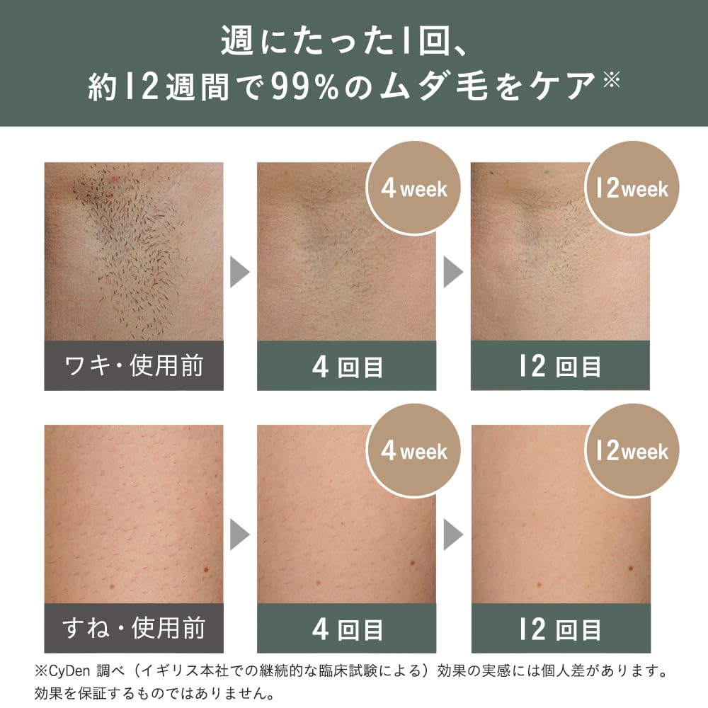 スムーズスキン pure fit 家庭用 光脱毛器 100万回照射 ヒゲ脱毛 産毛