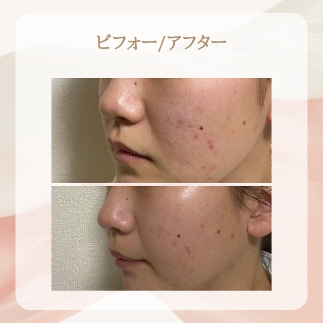 Roseclay Treatment Pack ローズクレイ　トリートメント　パック