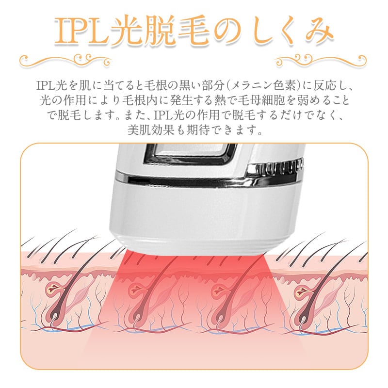 たかの友梨 ミラクルハイパー21 脱毛器 美顔器 イオン導入 脱毛 美肌