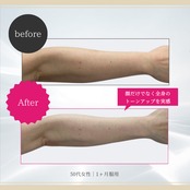 2セット❄︎クリスタルザクロ UV ホワイトカプセル