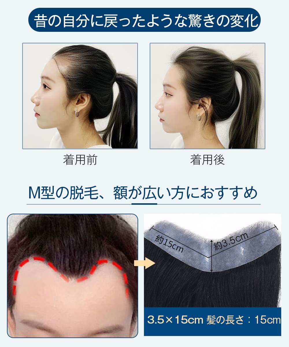 HIYE 部分ウィッグ 生え際 増毛シート 人毛100% 自然 通気性 黒 抜毛症