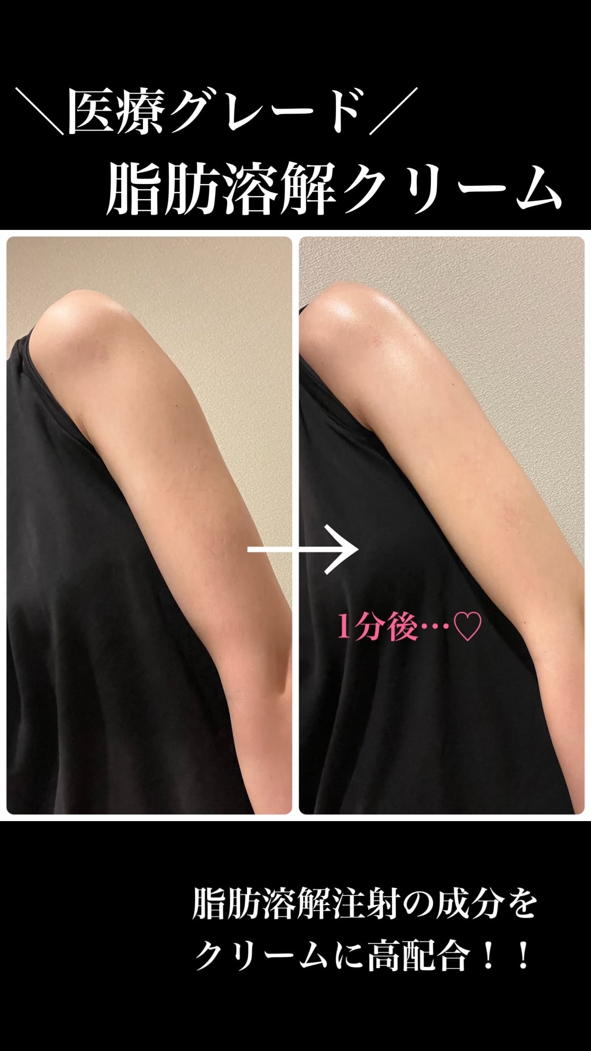 人気No.1 脂肪溶解クリーム | La Beaute Verite