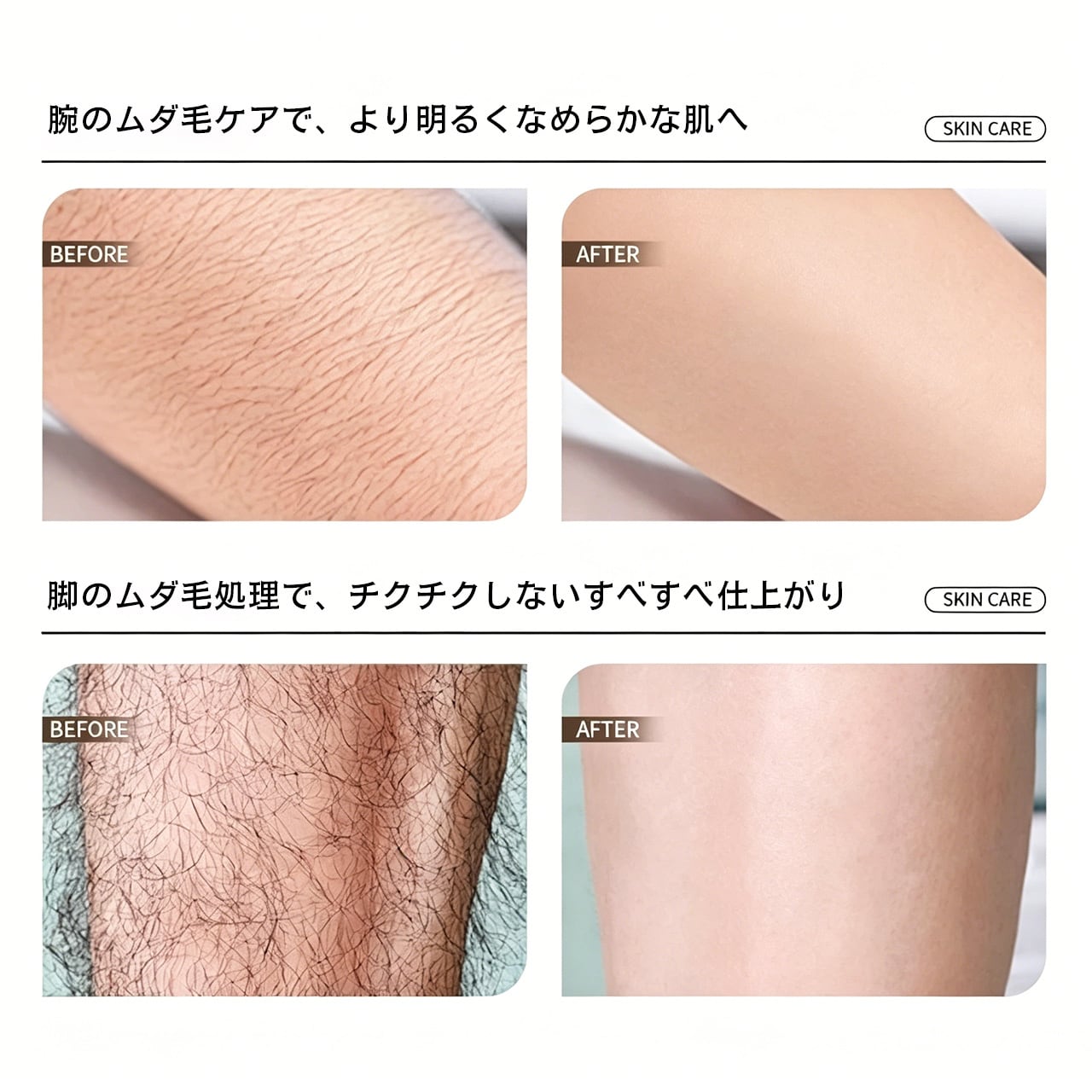 G48 .男女兼用・やさしく肌にやさしい水洗いOK家庭用脱毛器