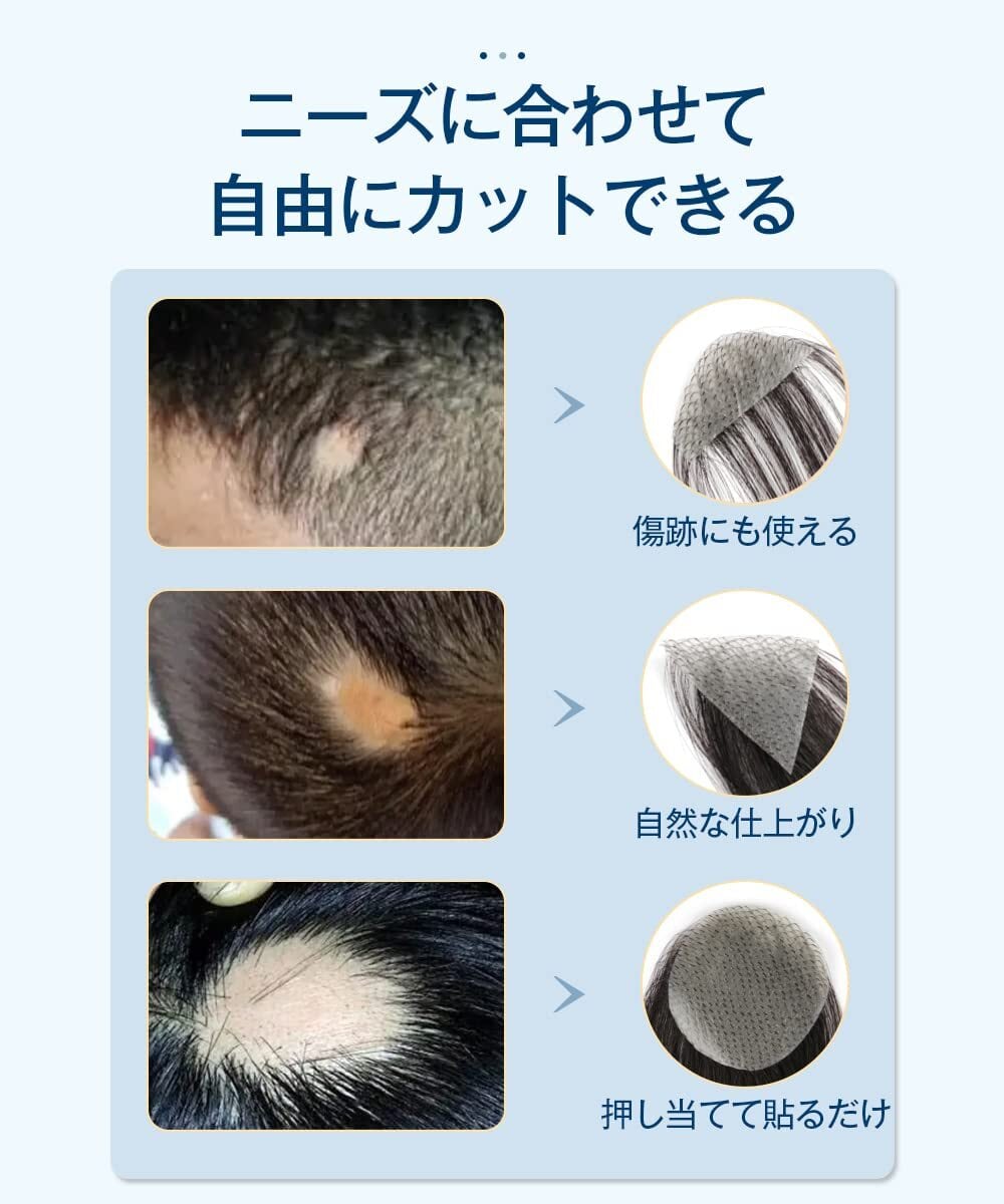 HIYE 部分ウィッグ 生え際 増毛シート 人毛100% 自然 通気性 黒 抜毛症