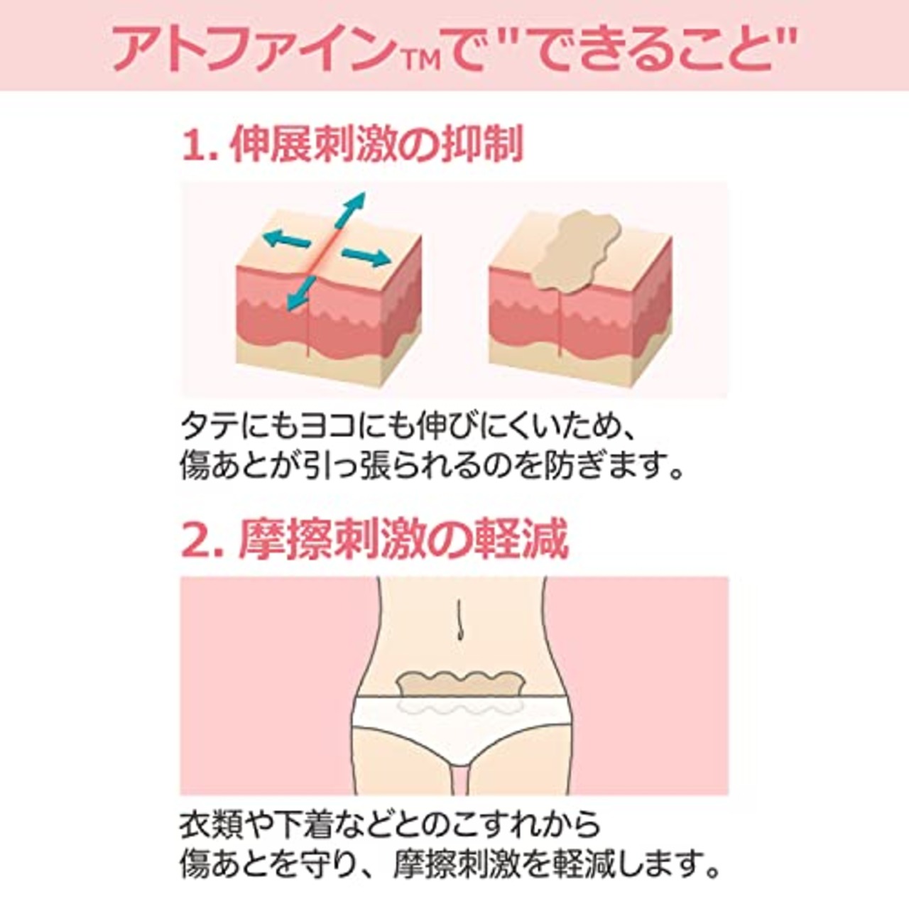 ニチバン 傷あとケア用品 アトファイン 傷あとケアテープ Lサイズ 50mm×164mm ATFL