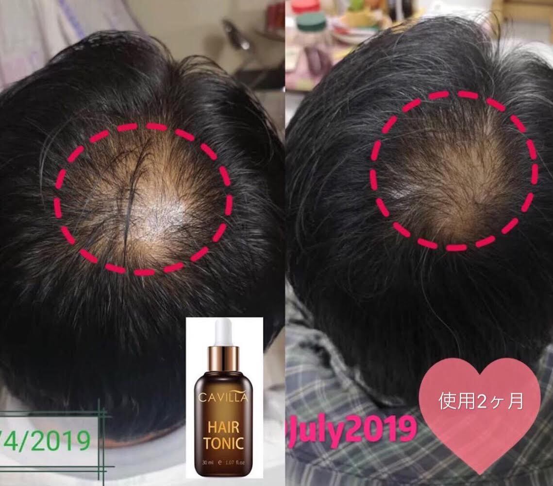 幻想的 cavilla トニック 30ml 2本セット | alamiah.edu.sa