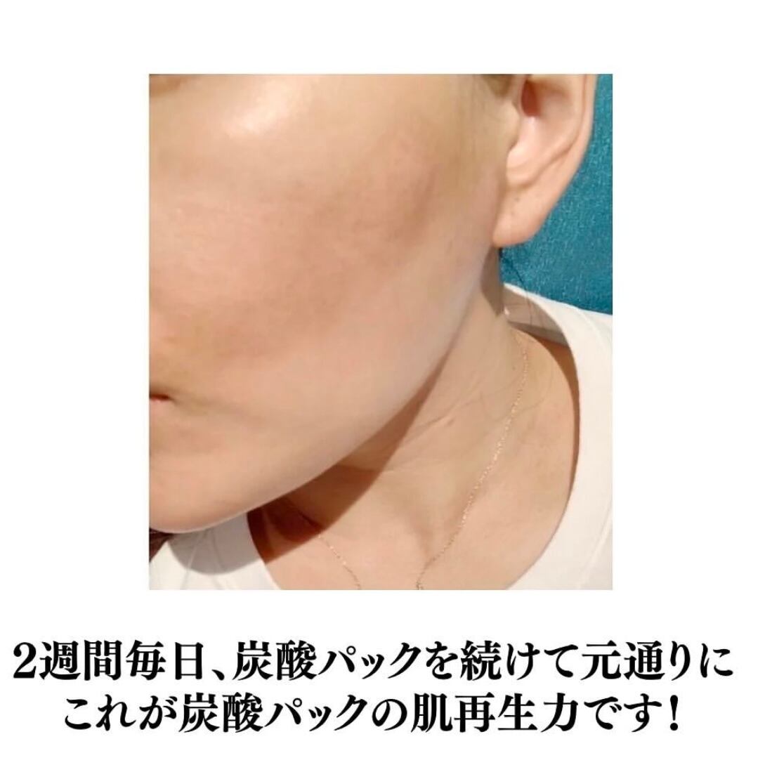 Sango】ダブルエナジーCO2ジェル5回分(高濃度炭酸パック) | nemuriselect