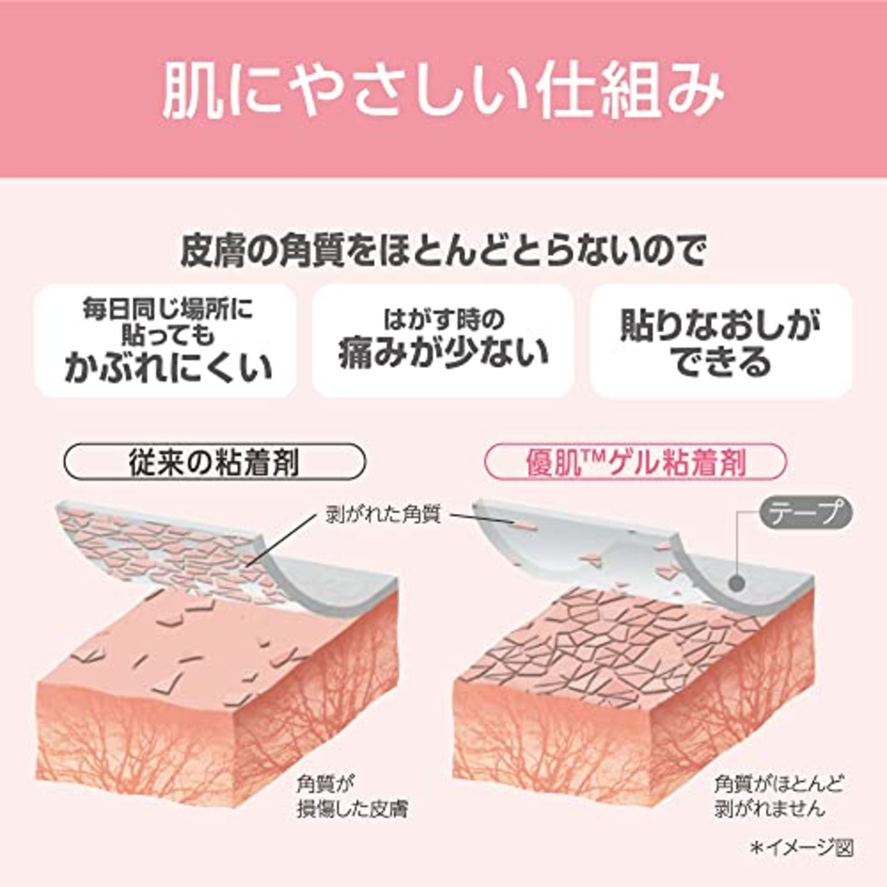 ニトムズ 優肌絆 プラスチック 25mm×7m 12巻入 (品番3512) 肌にやさしい かぶれにくい 手できれいに切れる透明タイプ サージカルテープ