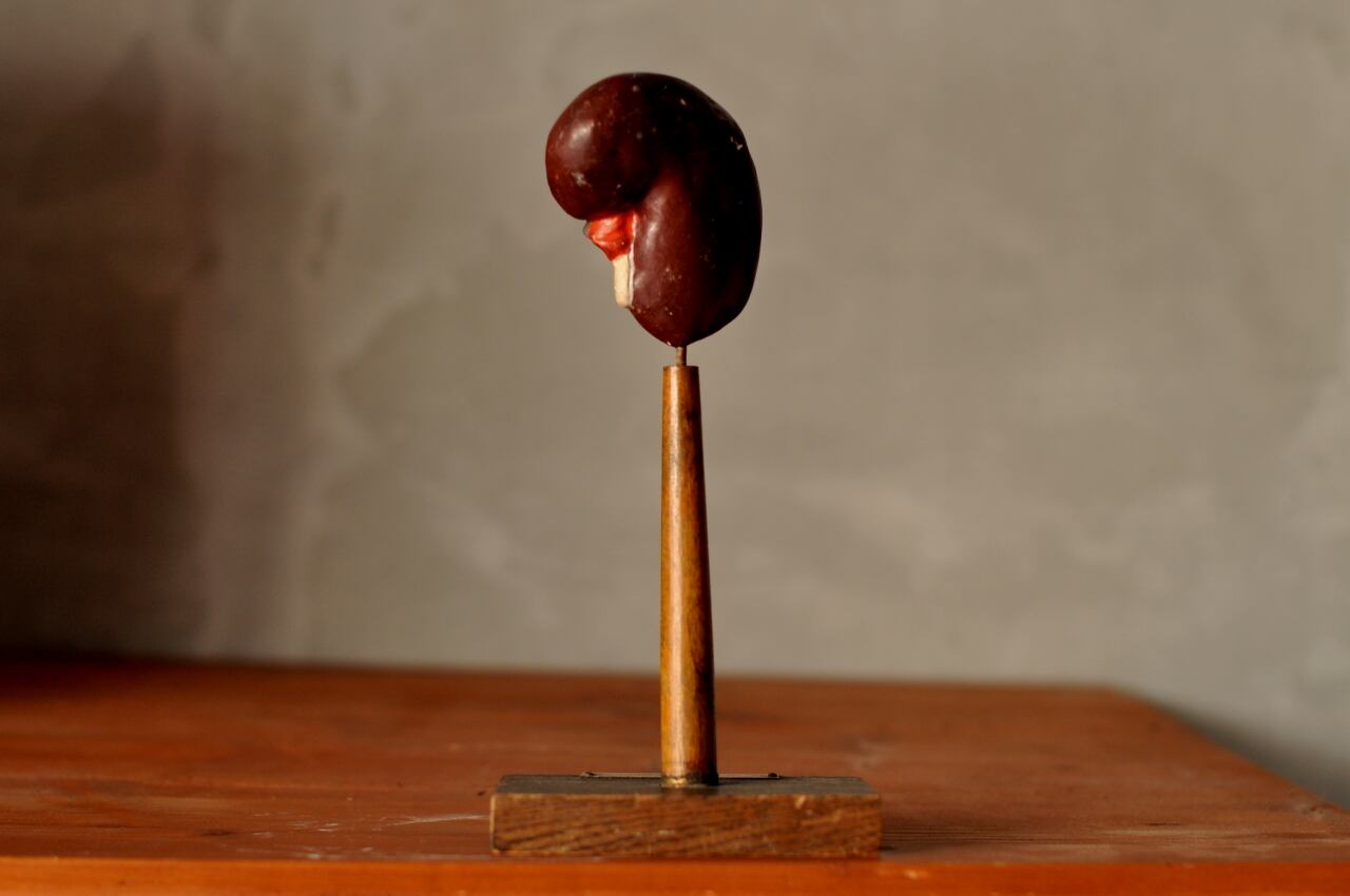 Human anatomical model(kidney)