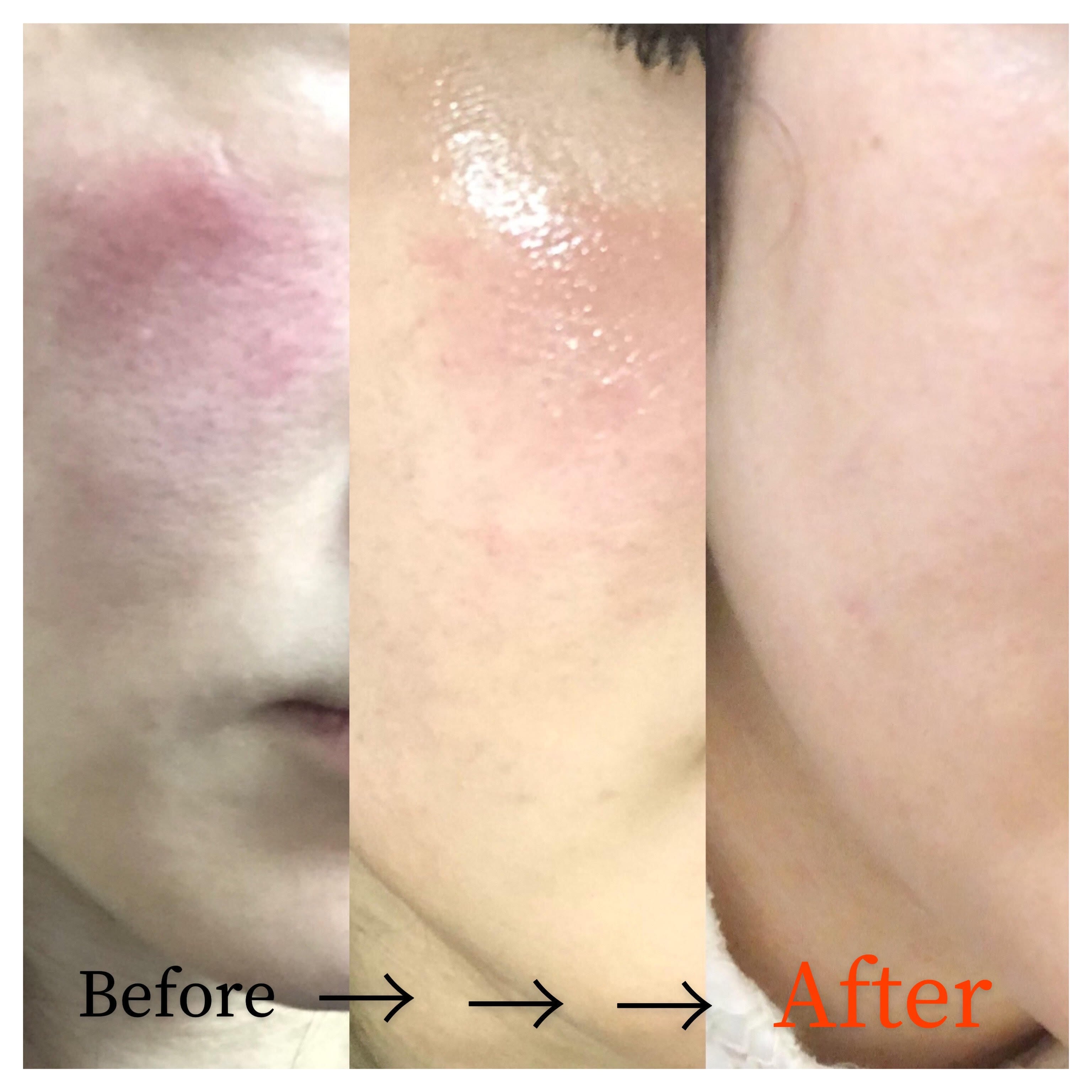 PlatinumRevo プラチナ3Sジェル（美容液） | BeautyPlusビューティ