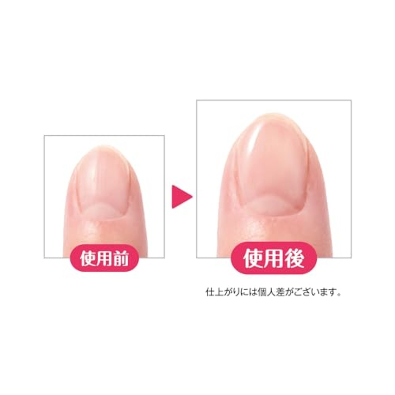 コージー ネイリスト 補強コート ファイバーインプロテクション トップコート 爪が薄く欠けやすい方に