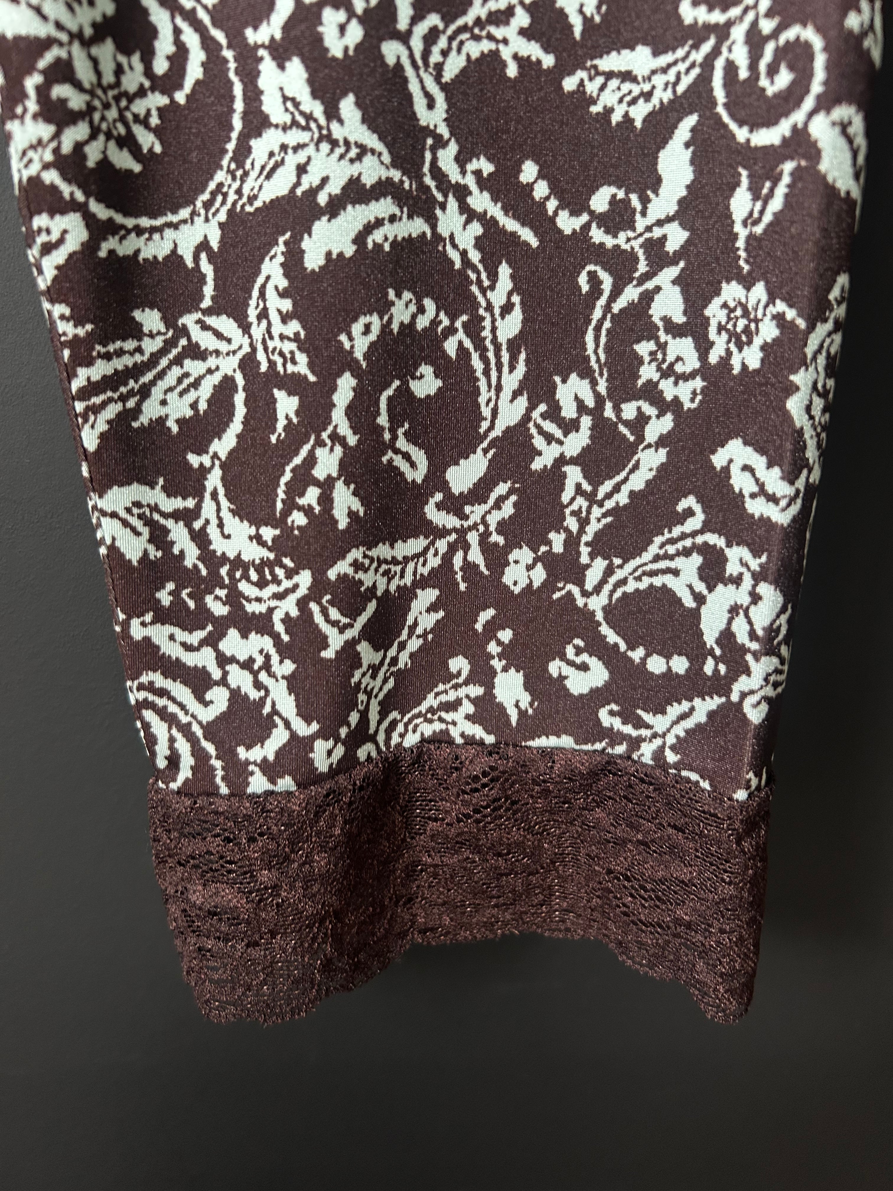 PERVERZE Lace-Trim Mid-Calf Shorts | AAR