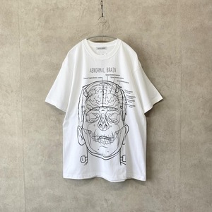 ABNORMAL BRAIN T-shirt / white【PsychoWorks】