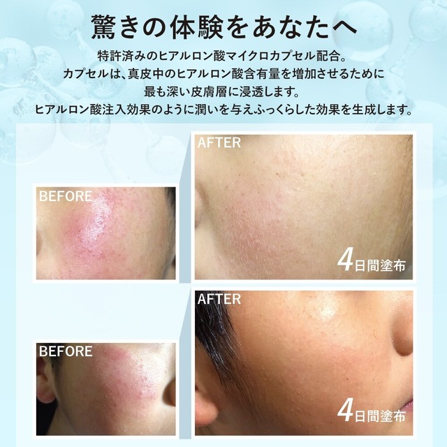 CHRISTINA クリスティーナ テラスキン ラインリペア 30ml