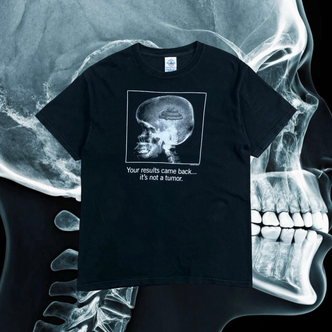00s It’s Not a Tumor X-Ray Skull T-Shirt
