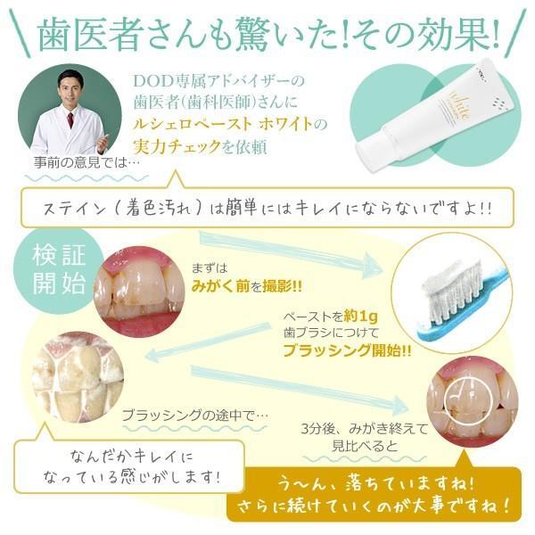 ルシェロ 歯みがきペースト ホワイト 6本セット ホワイトニング 医薬部