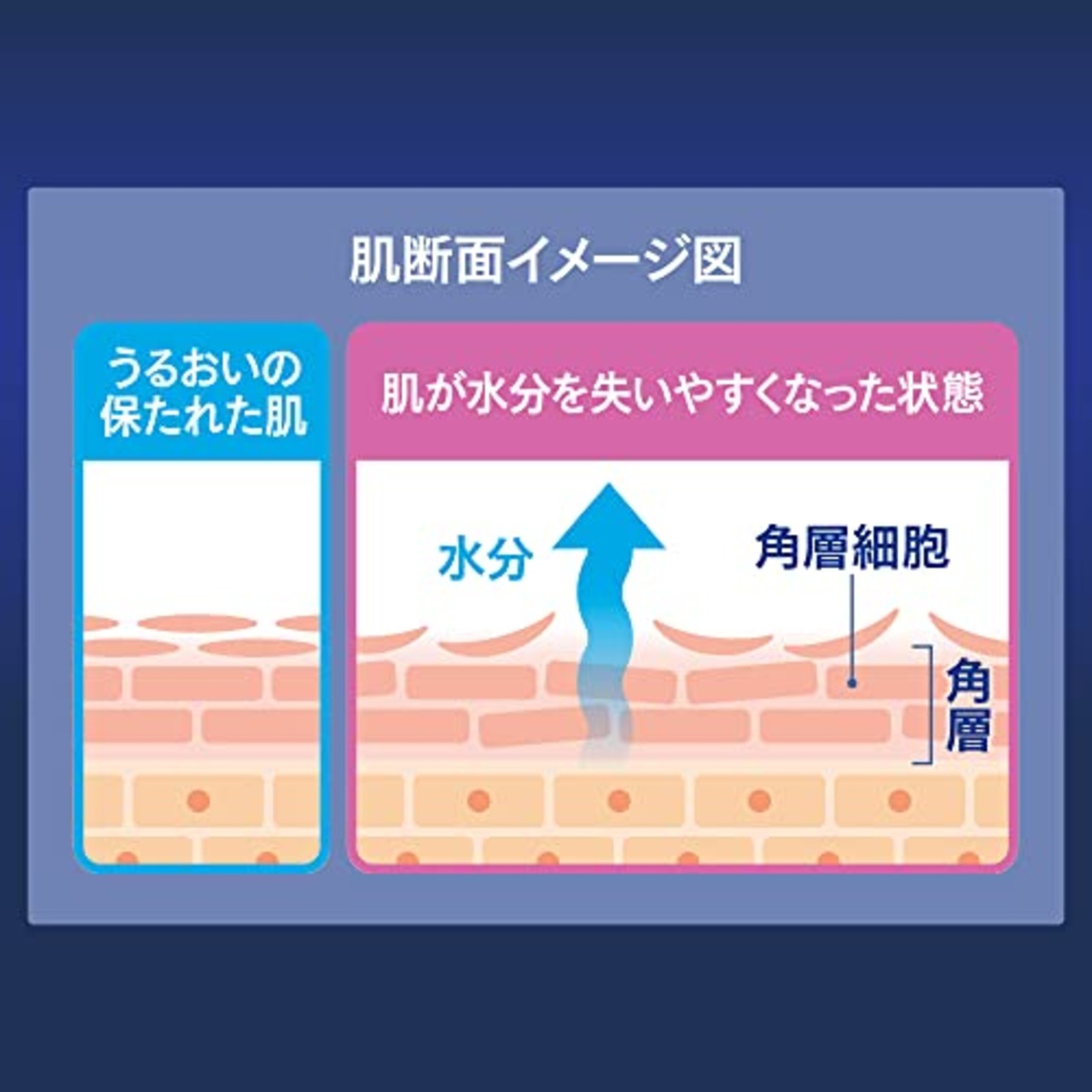 ニベアニベア ロイヤルブルー ボディミルク 乾燥 トラブルケア 200g 〔医薬部外品〕【肌荒れ・粉ふきがちな肌に】 無香料・無着色ボディクリーム本体
