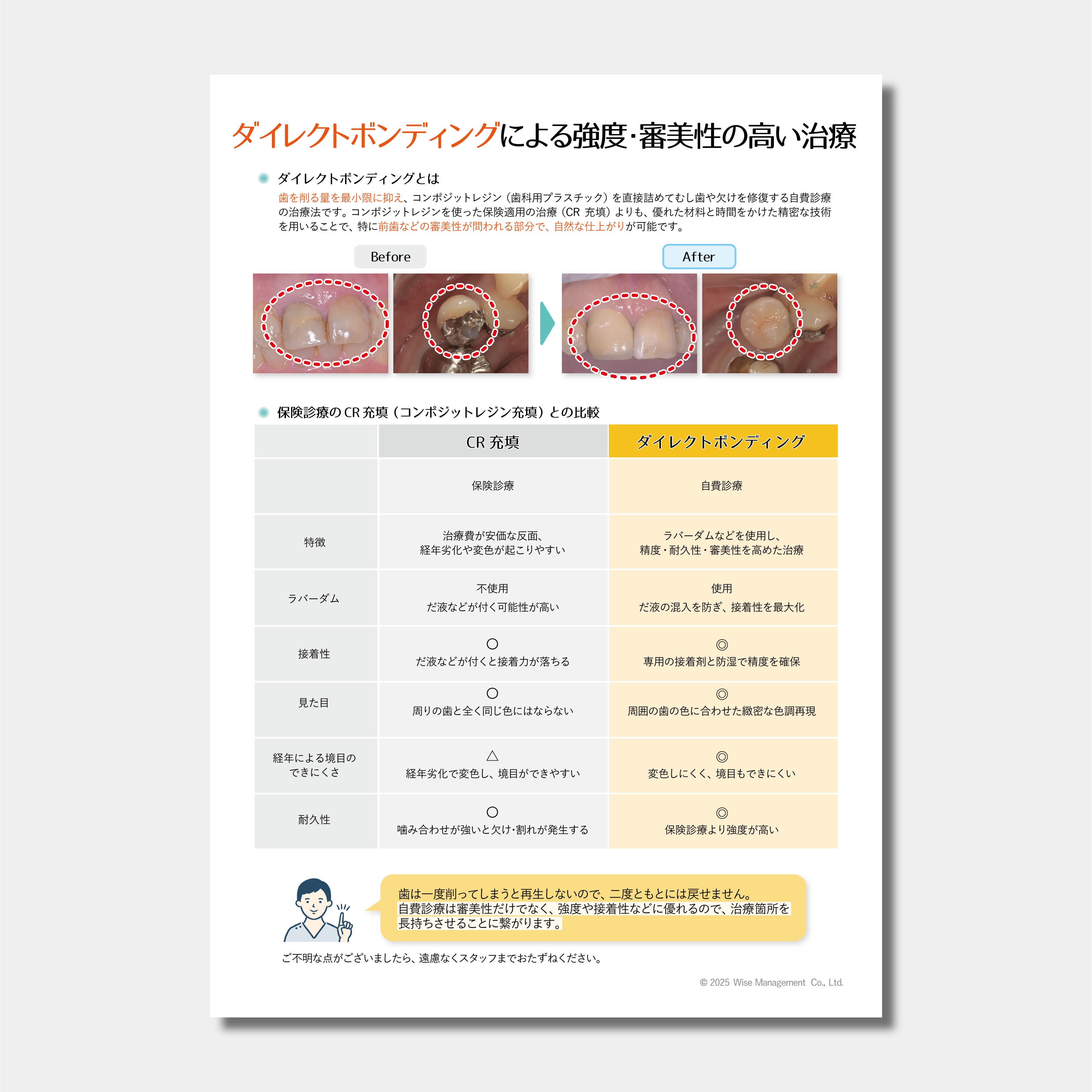 【データ販売】ダイレクトボンディングによる強度・審美性の高い治療