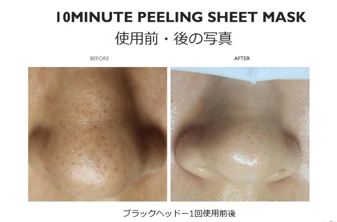 角質ケア】10ミニッツPEELING シートマスク23g×5枚 | itta