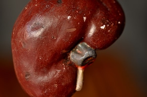 Human anatomical model(kidney)