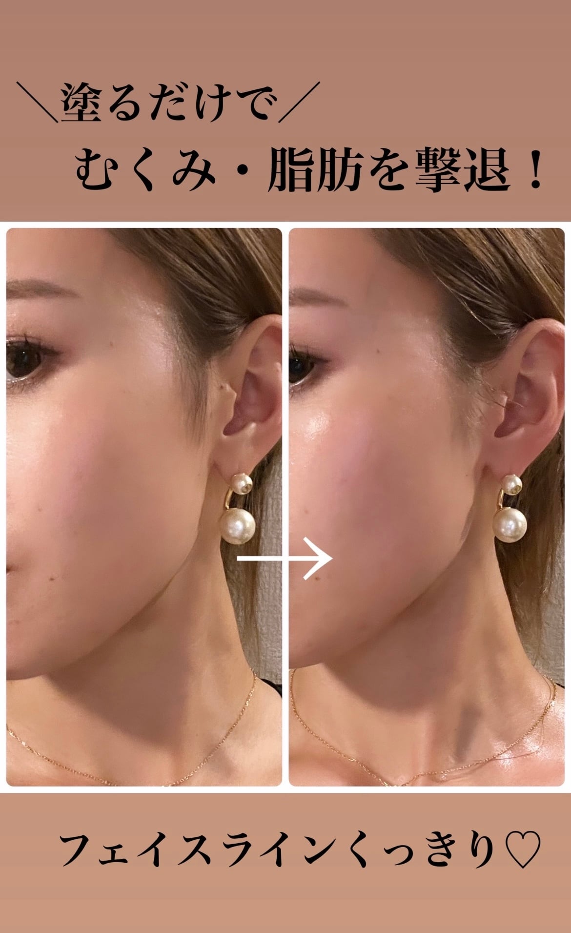 新品 プルマモア 脂肪溶解クリーム 人気No.1 脂肪溶解クリーム | La Beaute Verite
