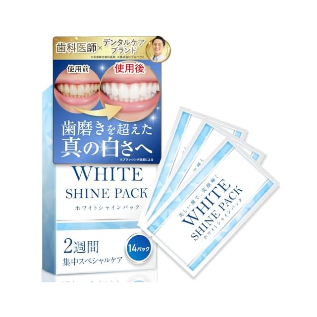 ホワイトニングに最適】マウスオープナー/オーラルワイダー/歯科