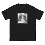 【309】X-ray Tee Black
