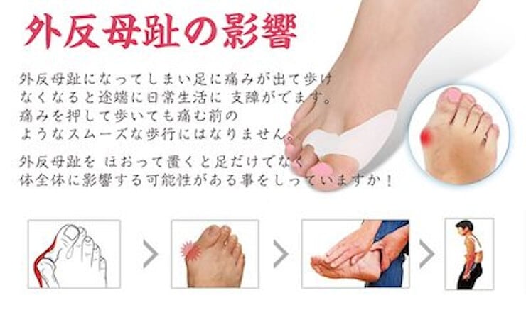 送料無料】外反母趾矯正シリコンパッド サポーター つま先 スト
