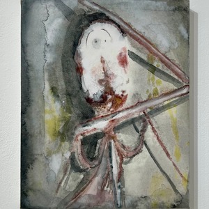 アラキドン　みつけられた