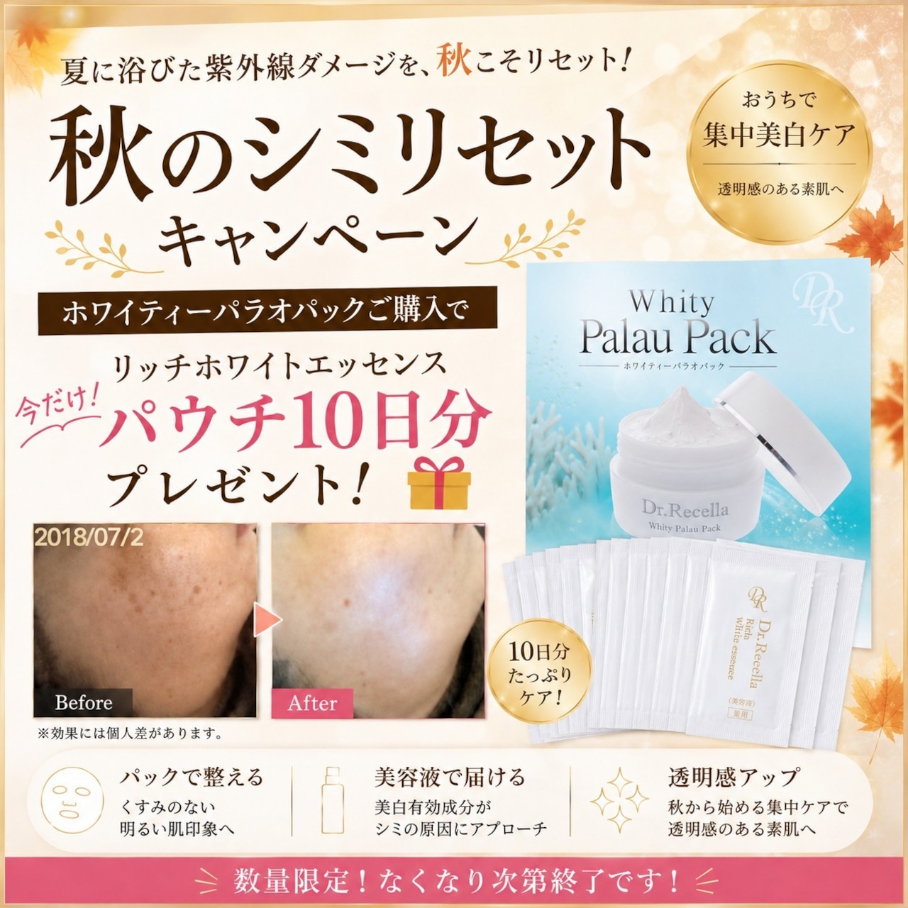 【9月キャンペーン特典付き★】ホワイティーパラオパック➕