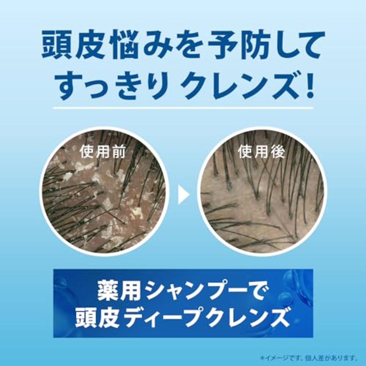 h&s シャンプー 2.2L 詰め替え大容量 モイスチャー エイチアンドエス