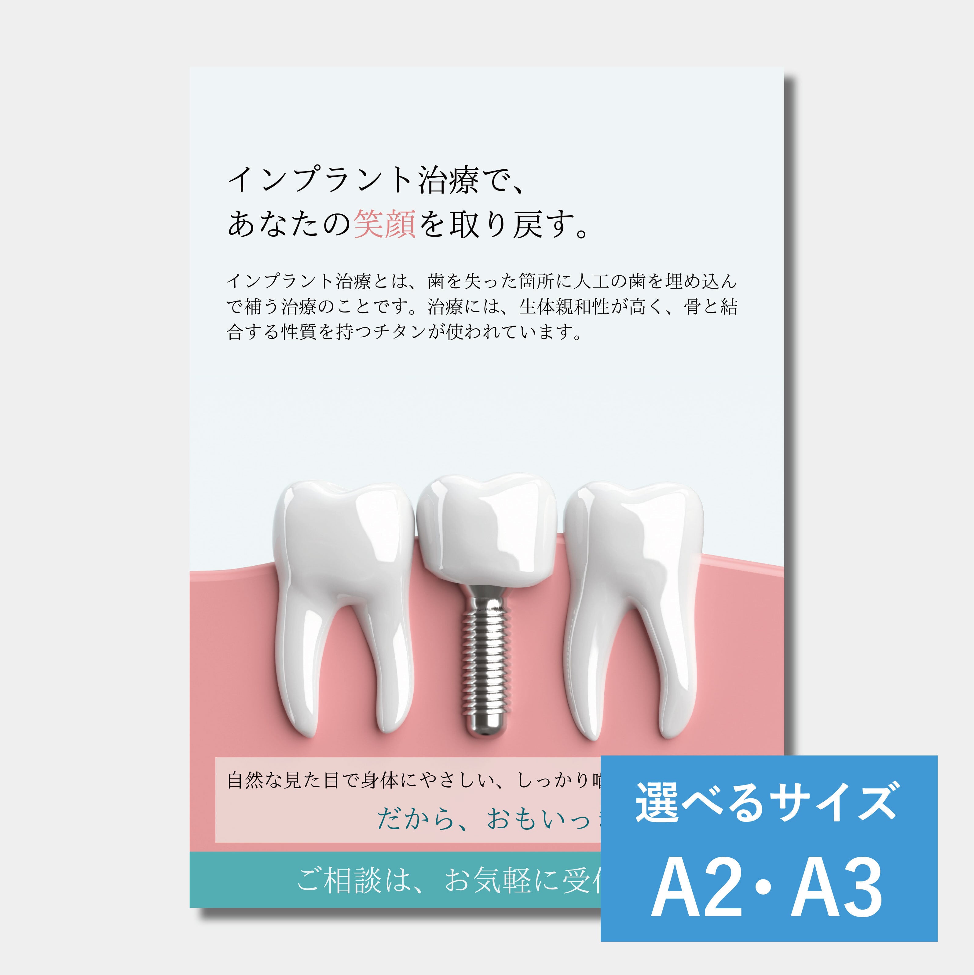 ポスター　インプラント