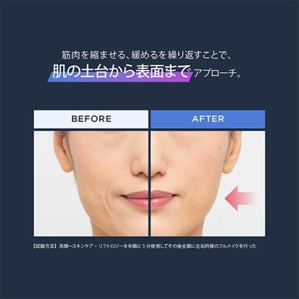 送料無料】YA-MAN リフトロジーSP | Beauty Place公式オンラインストア