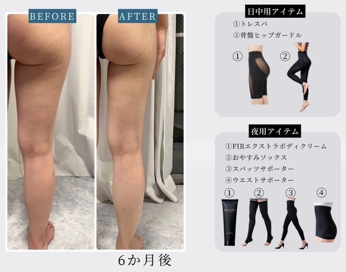 身体の2/3を光電子で覆う⚿スパッツサポーター 10分丈 光電子